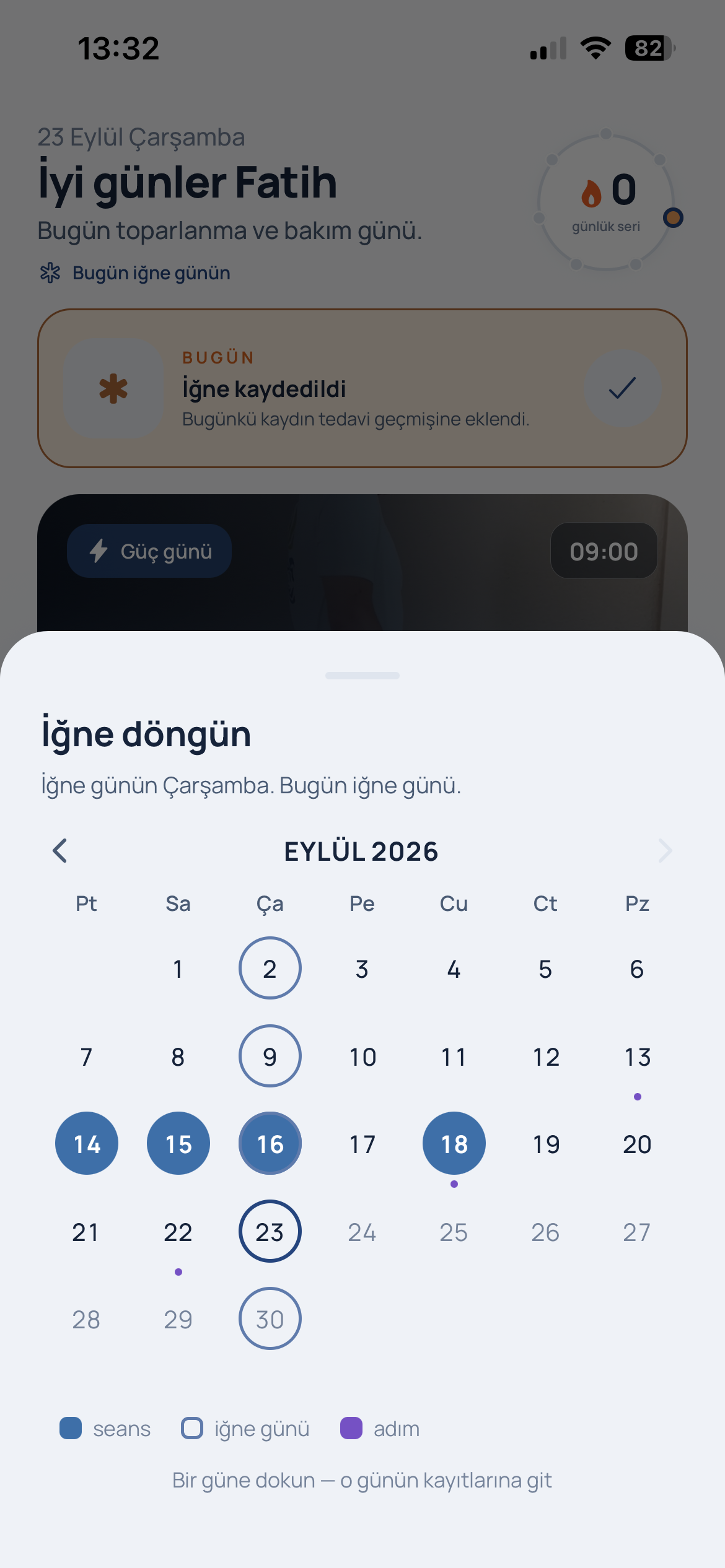 Stappn iğne döngüsü ekranı